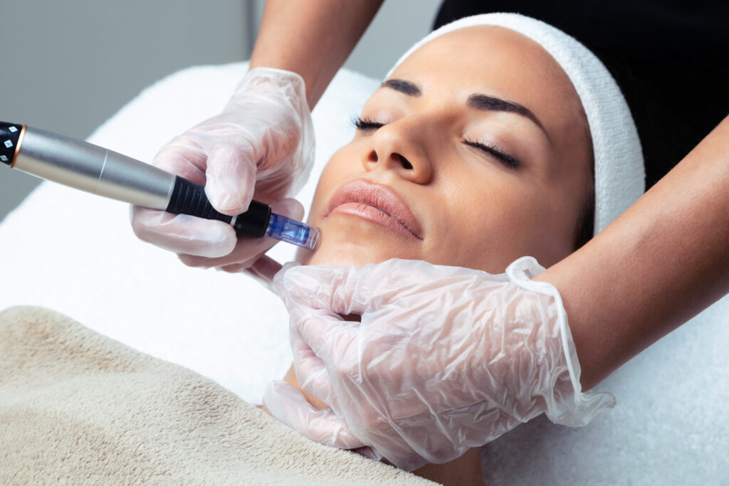 Shot,Of,Cosmetologist,Making,Mesotherapy,Injection,With,Dermapen,On,Face